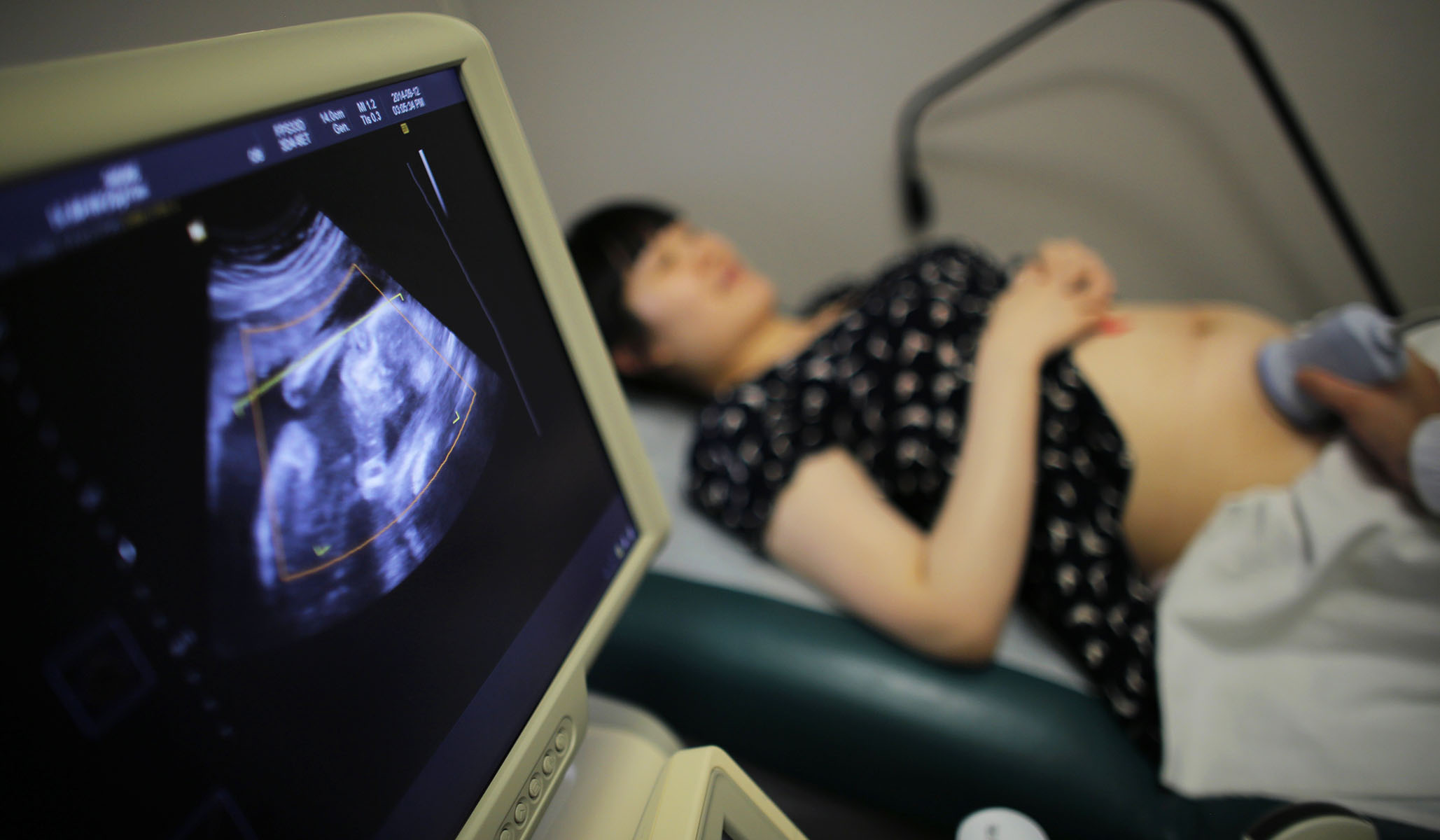 NextImg:Florida Heartbeat Bill Advances Through Legislature