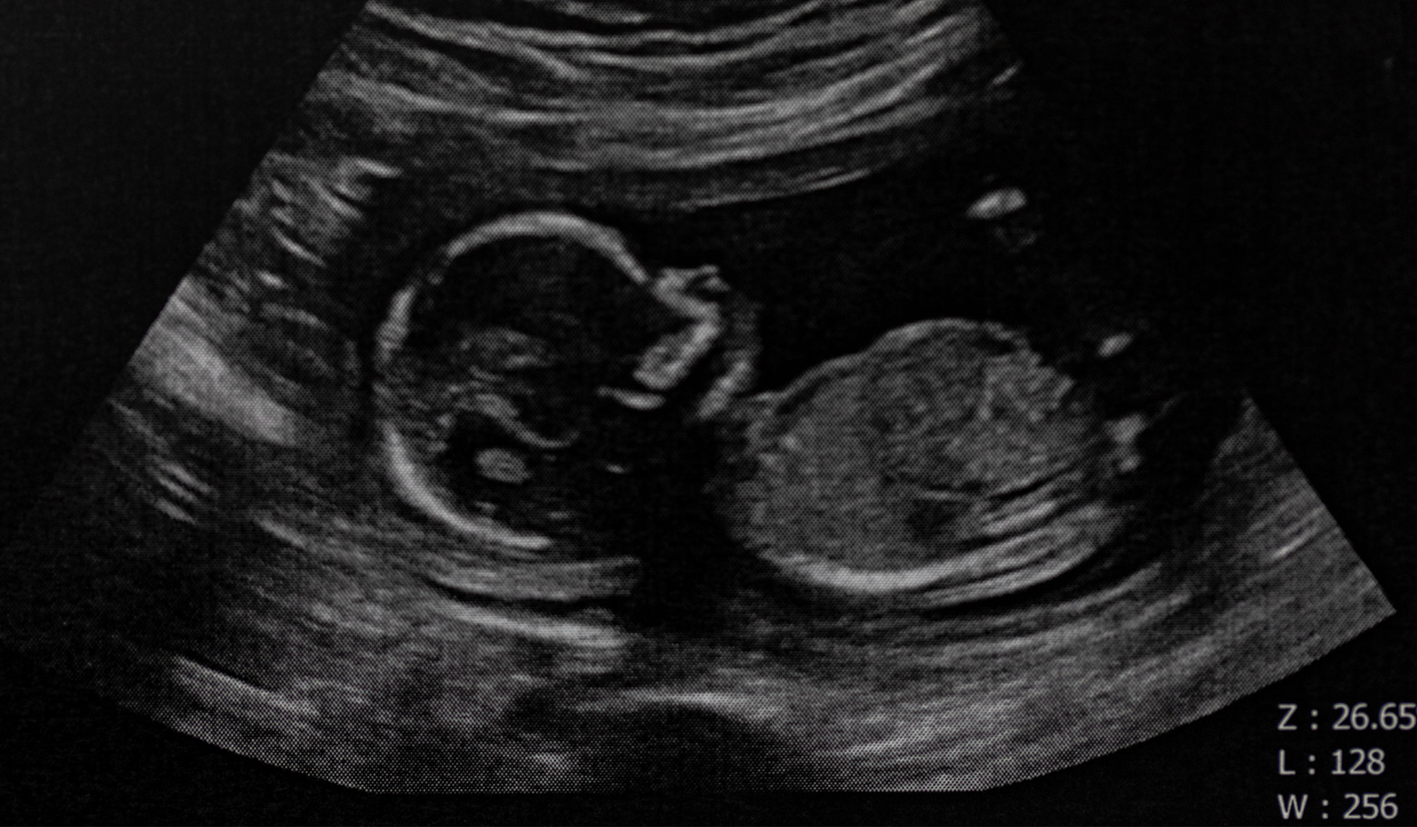 Abortion and the Eyeball Test