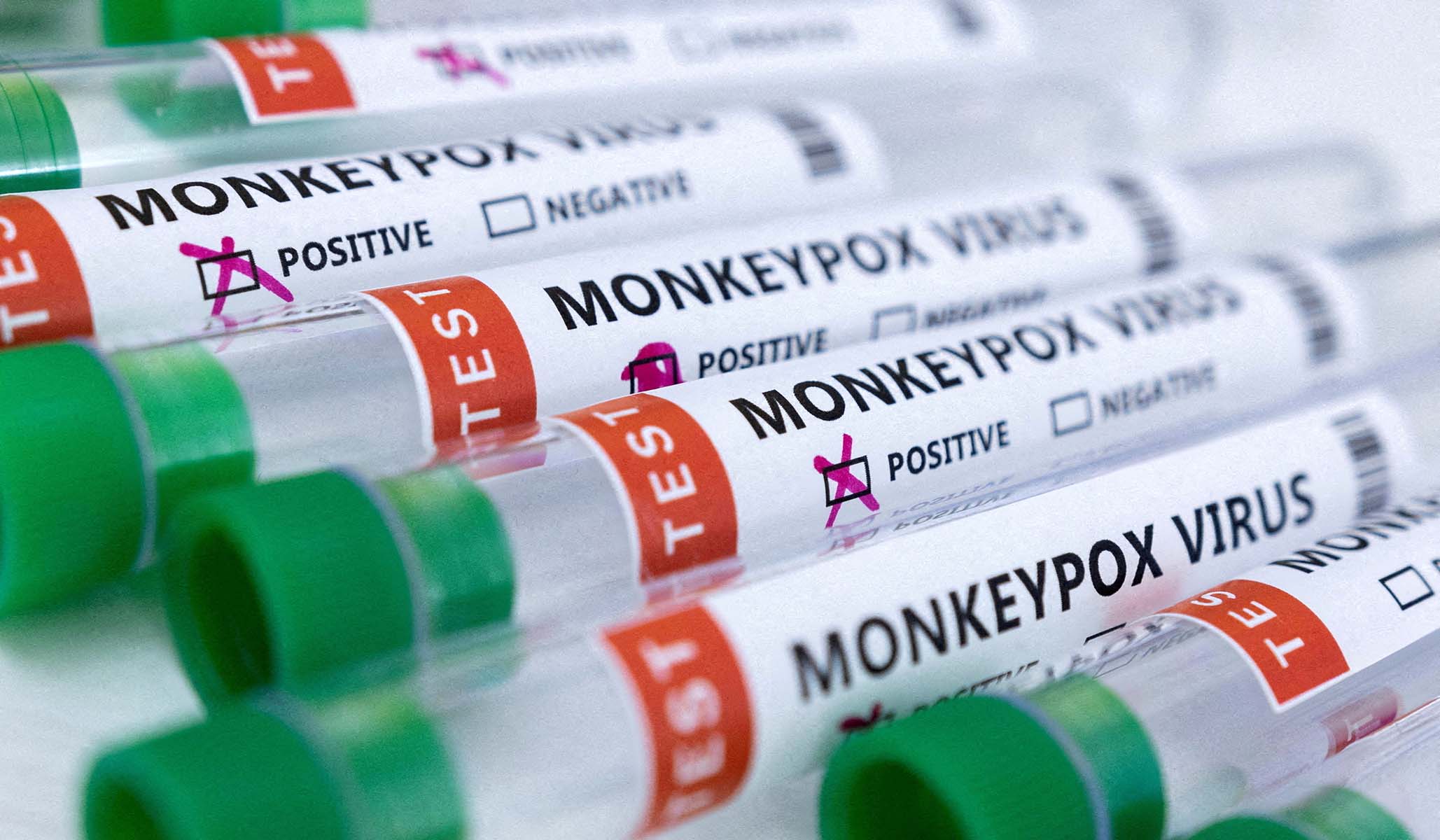 Monkeypox Outbreak Leveling Off, No Thanks to Government Monkeypox Outbreak Leveling Off, No Thanks to Government