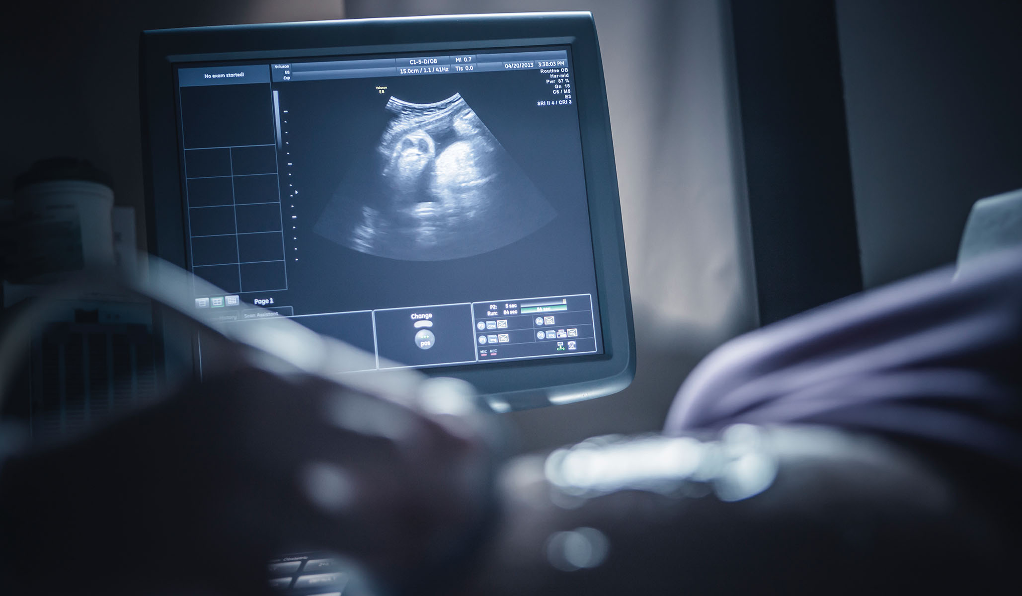NextImg:The Corner: Half of All States Now Limit Elective Abortion to Twelve Weeks or Earlier