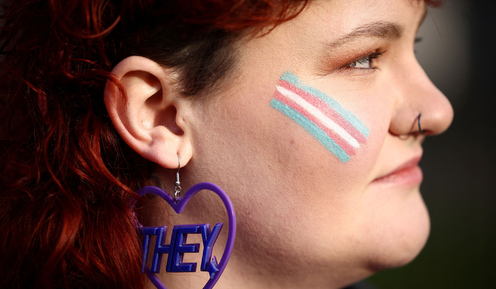 NextImg:The Corner: Gender-Distressed Patients Are Being Misled